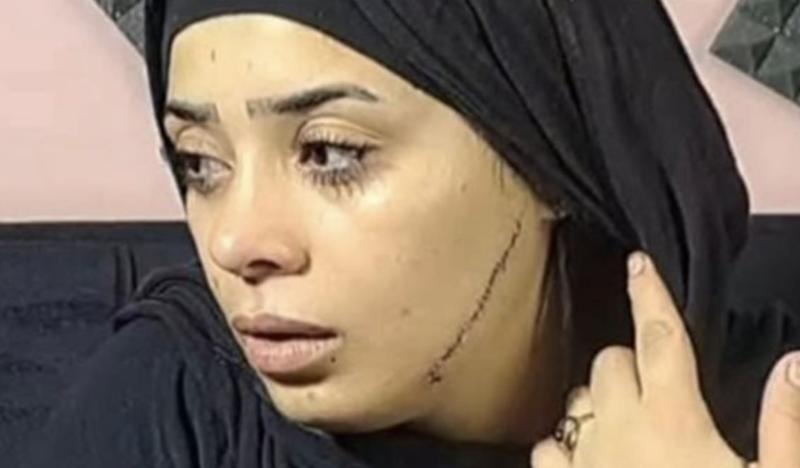 ضربتها بالموس.. محاكمة المتهمة بتشويه وجه عروس طليقها في مصر القديمة